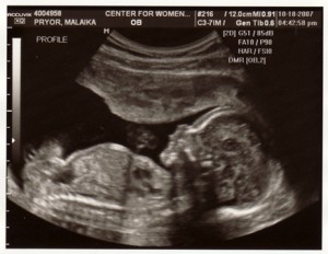 Baby 300x2322